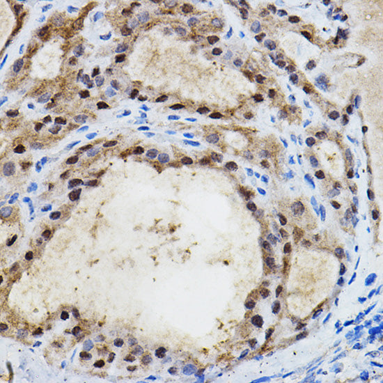 EPAS1/HIF2α Rabbit pAb