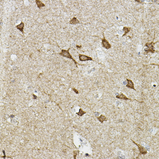 EPAS1/HIF2α Rabbit pAb
