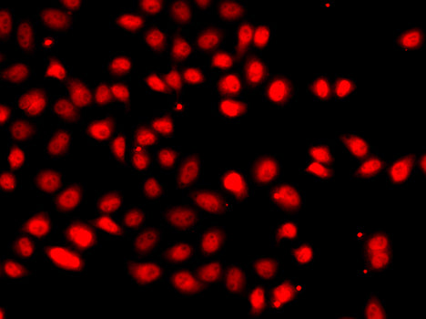 EPAS1/HIF2α Rabbit pAb
