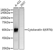 Cytokeratin 6 (KRT6) Rabbit pAb