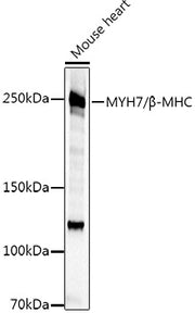 MYH7/β-MHC Rabbit pAb