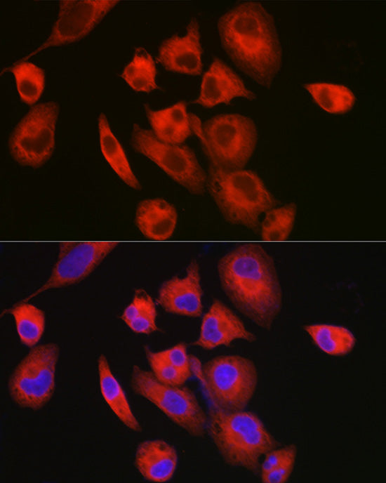 MYH7/β-MHC Rabbit pAb