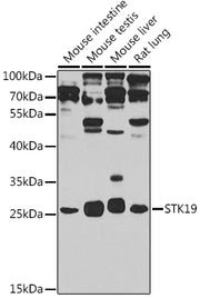 STK19 Rabbit pAb
