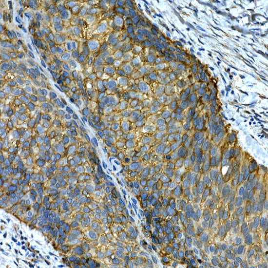 [KO Validated] Integrin alpha 2 (ITGA2/CD49b) Rabbit pAb