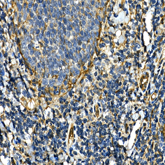 [KO Validated] Integrin alpha 2 (ITGA2/CD49b) Rabbit pAb