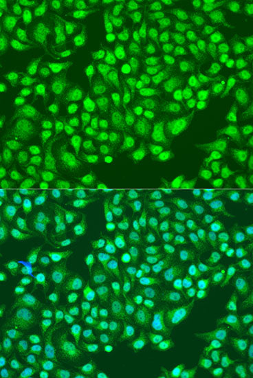 [KO Validated] Integrin alpha 2 (ITGA2/CD49b) Rabbit pAb