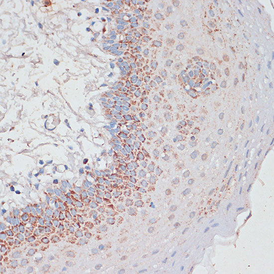 Desmoplakin Rabbit pAb