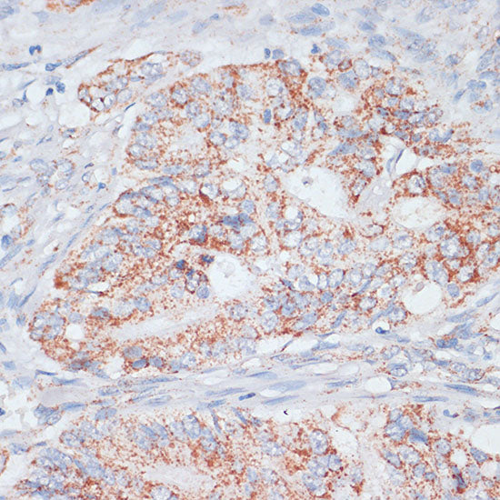 Desmoplakin Rabbit pAb