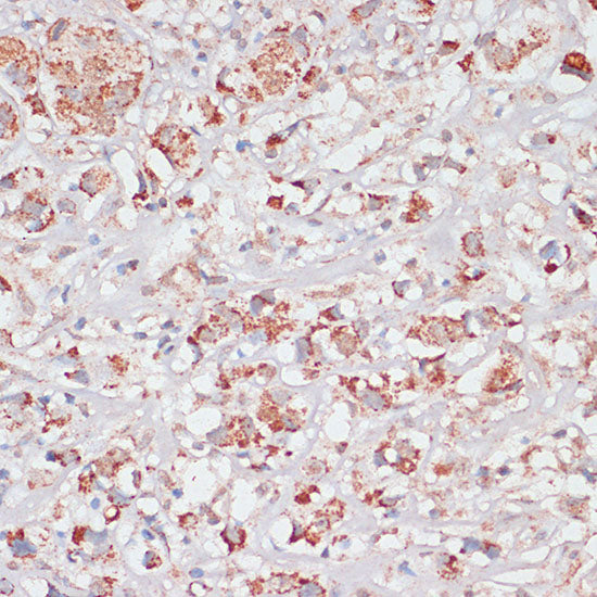 Desmoplakin Rabbit pAb
