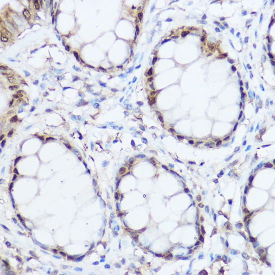 Thioredoxin 1 (Trx1/TXN) Rabbit pAb