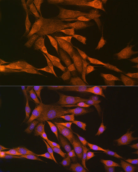 Thioredoxin 1 (Trx1/TXN) Rabbit pAb