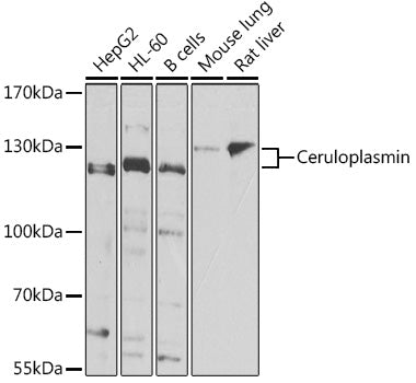 Ceruloplasmin Rabbit pAb