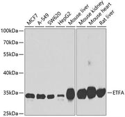 ETFA Rabbit pAb