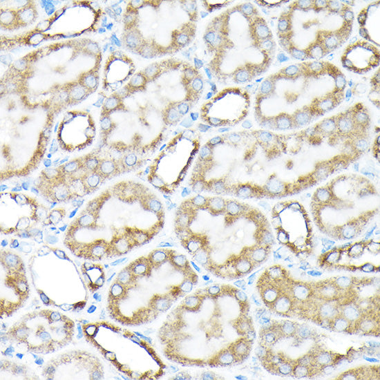 ETFA Rabbit pAb