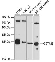 GSTM3 Rabbit pAb