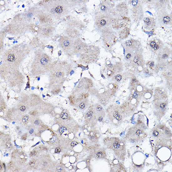 HSPA6 Rabbit pAb