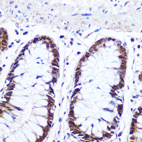 IRF1 Rabbit pAb