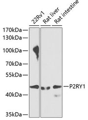 P2RY1 Rabbit pAb
