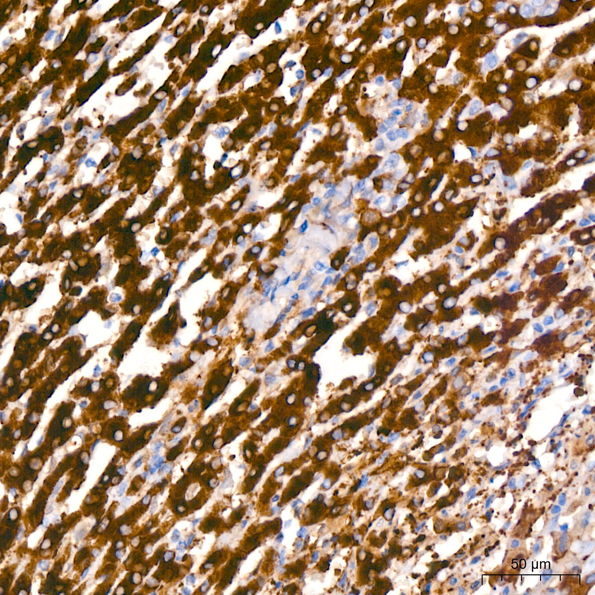 ALDH1L1 Rabbit mAb