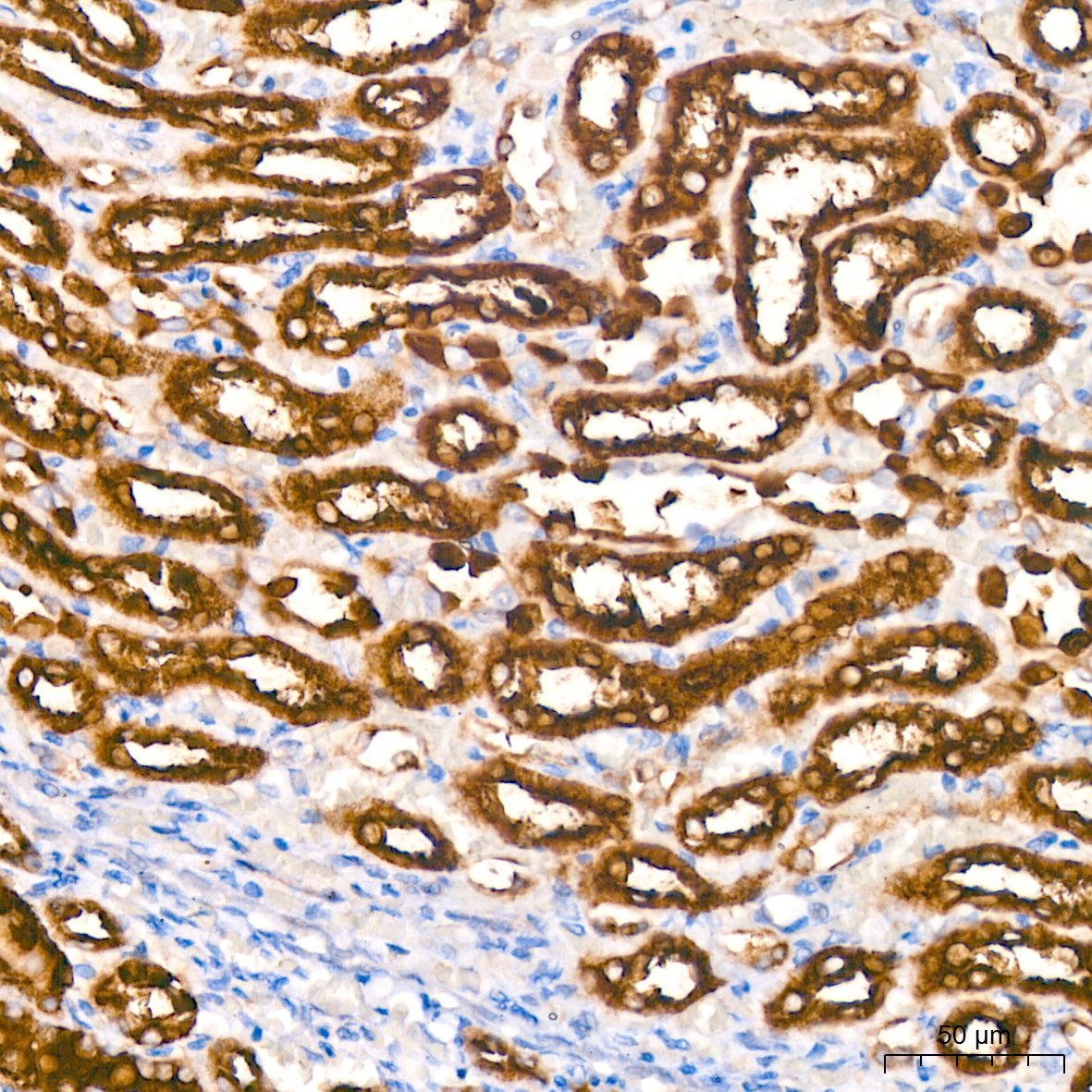 ALDH1L1 Rabbit mAb