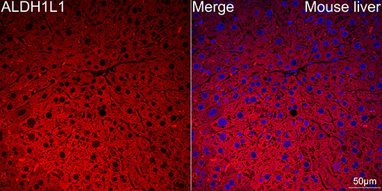 ALDH1L1 Rabbit mAb