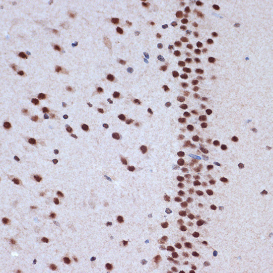 ACTL6A Rabbit mAb