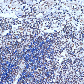 ACTL6A Rabbit mAb