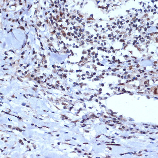 ACTL6A Rabbit mAb