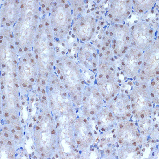ACTL6A Rabbit mAb