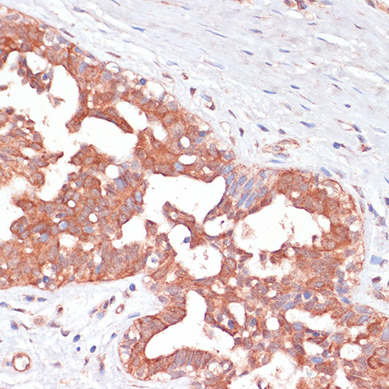 PGD Rabbit pAb