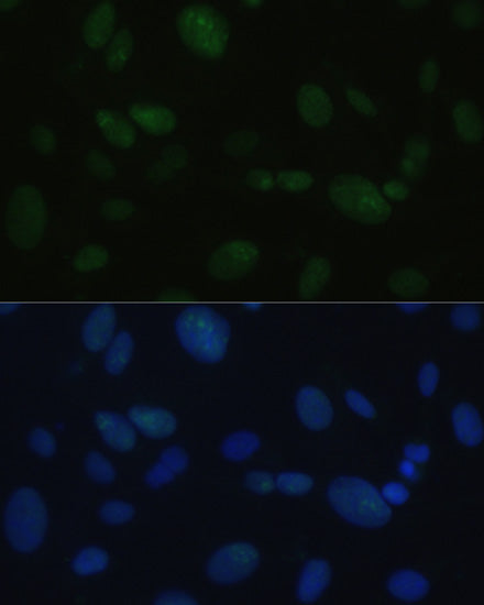 DNA-PKcs Rabbit pAb