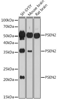 PSEN2 Rabbit pAb