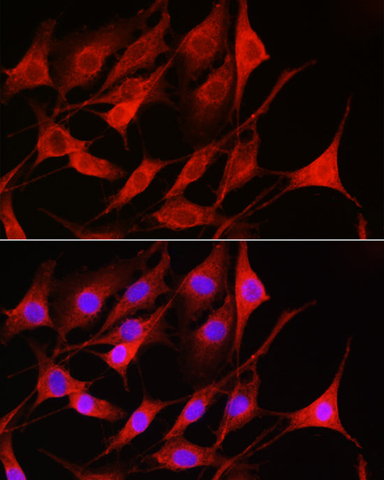 Rac1/2/3 Rabbit pAb