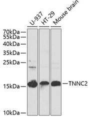 TNNC2 Rabbit pAb