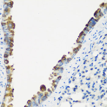 TNNC2 Rabbit pAb