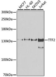 TTF2 Rabbit pAb