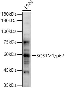 SQSTM1/p62 Rabbit pAb