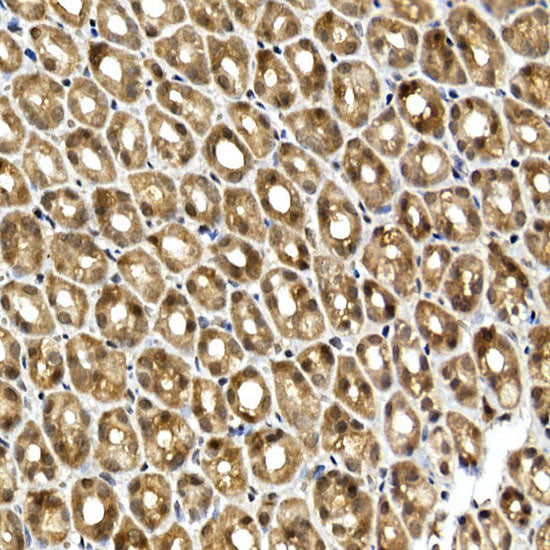 SQSTM1/p62 Rabbit pAb
