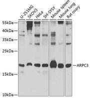 ARPC3 Rabbit pAb