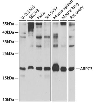 ARPC3 Rabbit pAb