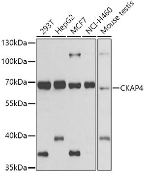 CKAP4 Rabbit pAb