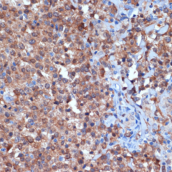 PKC delta Rabbit mAb