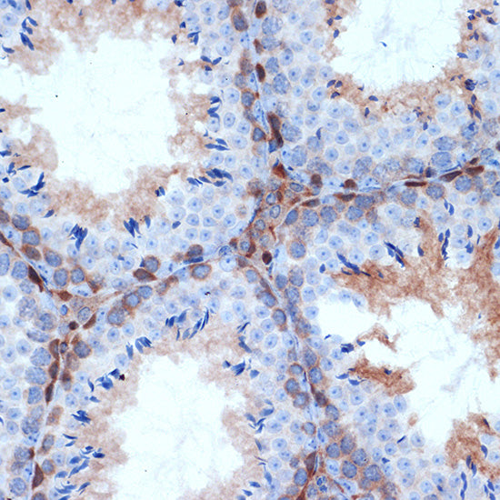 PKC delta Rabbit mAb