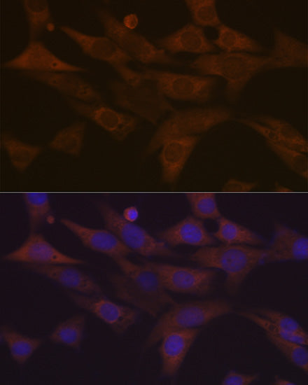 PKC delta Rabbit mAb