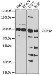 [KO Validated] SUZ12 Rabbit pAb