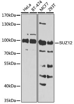 [KO Validated] SUZ12 Rabbit pAb