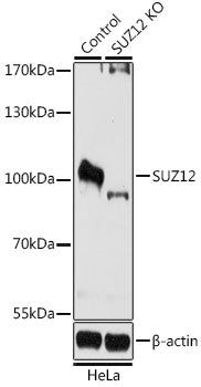 [KO Validated] SUZ12 Rabbit pAb