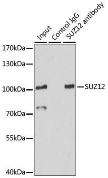 [KO Validated] SUZ12 Rabbit pAb
