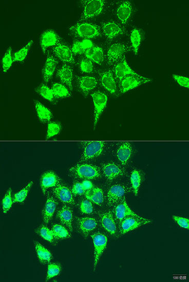 RASGRP3 Rabbit pAb
