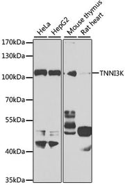 TNNI3K Rabbit pAb